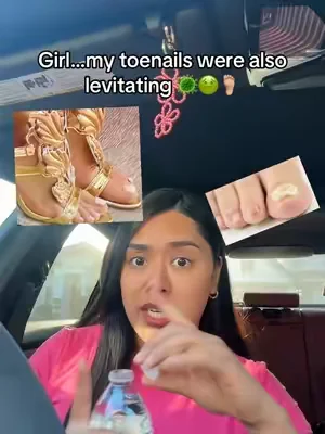 Jen girl I got you 🦶🏼🙅🏽‍♀️#fungus #toenailfungustreatment #nailfungus #jenloveisland 