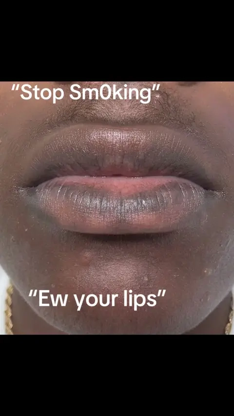 stop scrubbing at your lips and use a good lip serum