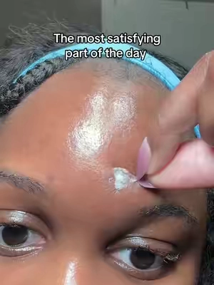 Invisible pimple patch #medicubepimplepatch #skincaretiktok #pimplepatchremoval #medicubeskincare #summerwins 