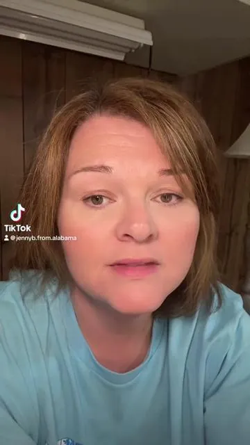 #creatorsearchinsights #trendingvideo #hairloss #hairtransformation #fypツ   
