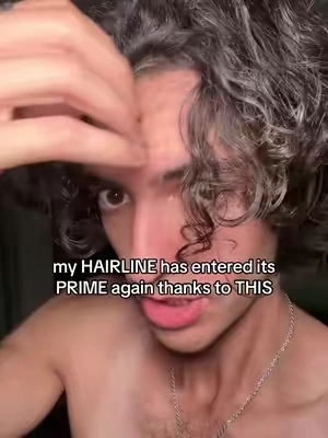 7659232670060170510