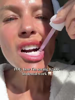 Dental work is expensive! Try this nano-hydroxyapatite serum before spending thousand at the dentist. It worked for me! *results may vary. Not medical advice* @Hismile US #toothacherelief #sensitiveteeth #nanohydroxyapatite #flouridefree #dentalwork 