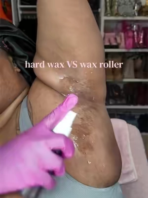 April Underarm Wax | comparing @Tress Wellness (beginners wax kit + gold beads VS. hard wax roller + lavender wax) #pmos #hirsuitism #pcos #underarmwax # 