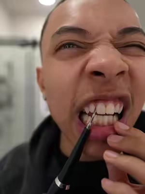Start using a mouth scraper if you have bad breath! #plaqueremover #dentalcare #oralcare #oralhygiene 