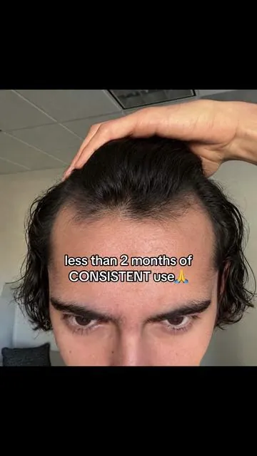 7660307070545104141