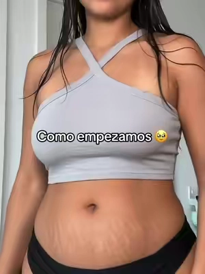 #estrias #summerwins #stretchmarks #flacidezabdominal #estriasembarazo AD Individual results may vary. Based on my own experience