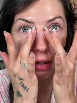 So so good. I mean look at them! #pdrn #pinkpeptideeyeserum #medicube #skincare #undereye 