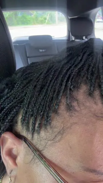 Traction alopecia is my story, so that’s the journey I’m sharing. Hair density changes can happen for many reasons like stress, hormones, medication, genetics, or traction. For me, it’s traction alopecia, and I’m documenting my progress as I use this hair density serum every day. Results aren’t guaranteed, but if you’d like to follow along or try the journey with me, you’re welcome to. Commission may be earned. #TractionAlopecia #HairDensity #HealthyHairJourney #HairCareTips #SummerWins