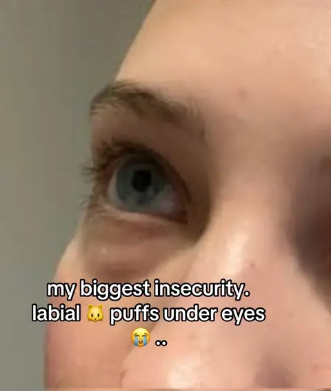 looks like an eye labial fold