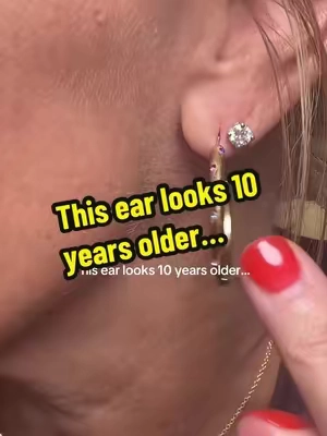 lob lifter earring backs, earring backs for stretched ears, droopy earlobes, heavy earrings, jewelry hack, earring support If your favorite earrings are making your earlobes look stretched or droopy, this tiny swap makes such a big difference. Same earrings, same ears… just different earring backs. I wish I had found these sooner! #jewelryhack #earringtips #fashionfinds #styleover40 #tiktokshop