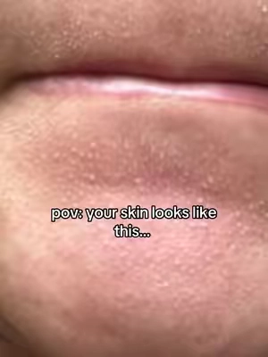#skin1004 #koreanskincare #glassskin #doublecleansing #skincareroutine 