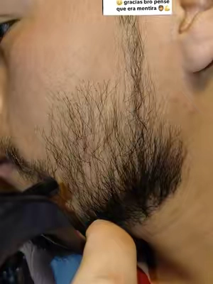 #minoxidil #barba #hairgrowth #tips #paratiiiii 