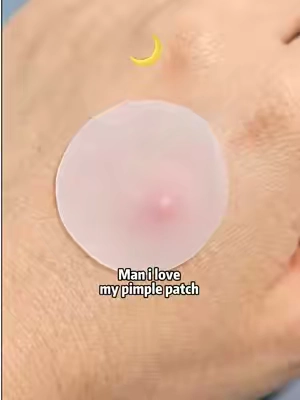 #fyp #tktkpimplepatch #pimplepoping #pimple #pimplepoping 