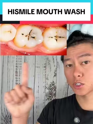 so glad this works so good! #gingivitis #cavity #oralhealth #teethsensitivity #hismile 