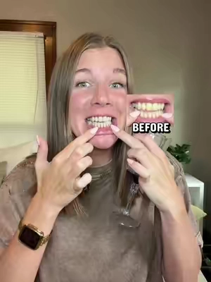 These results are insane…👀 @DR.DENT - shop 