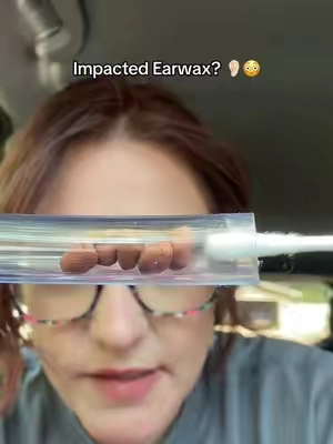 Sticky Ear Cleaning adhesive ear cleaning tool. Reusable & you won’t believe the amount of earwax and dirt that you’ll see in your ears.  #stickyearcleaner #earwax #earwaxremoval #earcleaning #tiktokshopcreatorpicks 