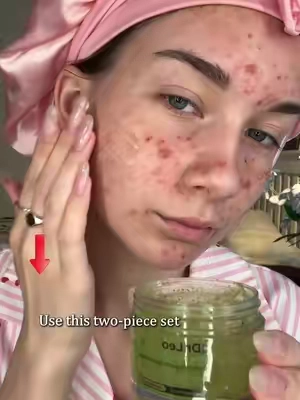 I've tried many methods, but none of them worked — until I tried Dr. Leo's acne-fighting duo.#skincare #skinbarrierrepair #breakout #acnetreatment #drleohonestreview 