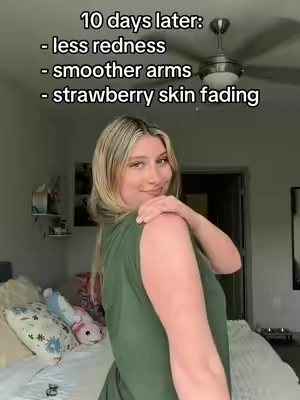 after years of hiding my arms, finally i found something working to clear my KP 🥲 #KP #strawberryskin #skintransformation #keratosispilaris 