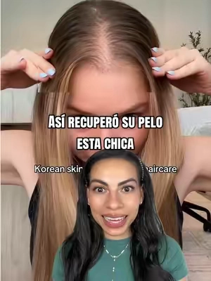 Así fue como esta chica logró que su pelo le creciera más grueso y abundante 💯💫✨ #hairserum #hairloss #hairgrowth #caidadecabello #pdrn @VT Cosmetics US 
