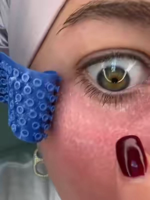 it’s SO satisfying and feels so good- and im shocked that it actually works #undereyes #eyemasks #underye #undereyebags #eyebags 