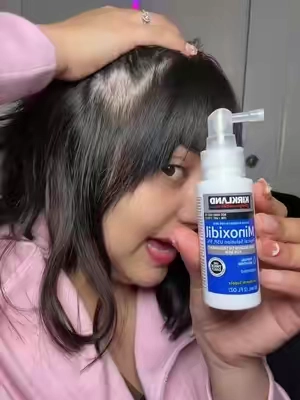 #minoxidilkirkland #minoxidilbarba #caidadelpelo #calvicia #paratiiiiiiiiiiiiiiiiiiiiiiiiiiiiiii 