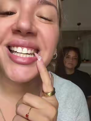 Are you kidding me !!!#tiktokshopcreatorpicks #drdentteethwhitening #aligners #tiktokbacktoschool 

Posted on 08/11/2026. Prices and promotions were accurate at the time of posting but may be subject to change. The statements shared are personal testimonials. Please note that results may vary.