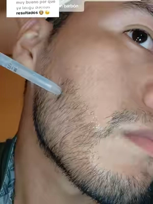 #tiktokshopcreatorpicks #minoxidil #paratiiiiiiiii #flyp #hairgrowthtips 