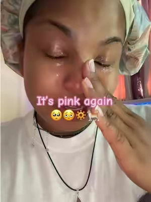 #brighteningskincare 