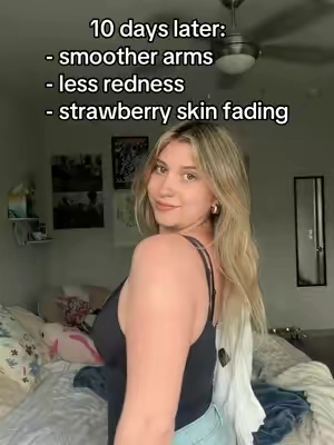 after years of trying, finally something’s working for me 🥲 #KP #strawberryskin #skintransformation #keratosispilaris 