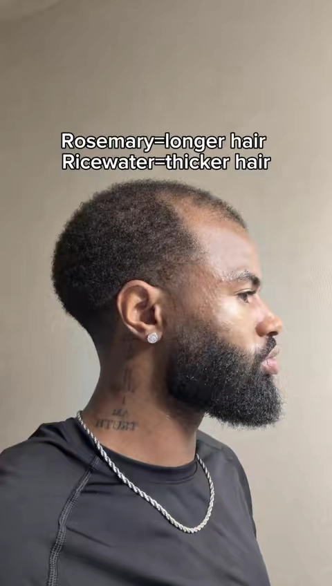 #hairgrowth #hairgrowthtips #balding #fyp #relateable 