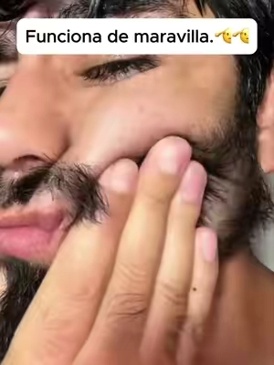 Funciona de maravilla. 🧔🧔 Se acabó la espera.💪💪#beardgrowth #beardcare #beards #beardmen #beardserum 