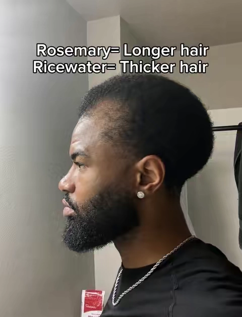 #hairtok #fyp #viral #hairline 
