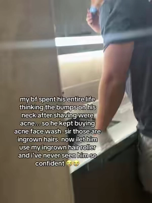 how sad 😭😭  #ingrownhair #shavingbumps #ingrownhairs #bfrelatable #couplegoals      