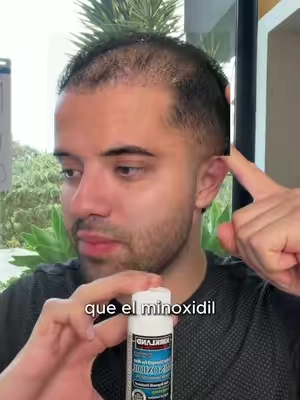 Yo no voy a ser otro que se deja caer el pelo viendo pasar oportunidades. 💪🔥 #haircare #hairhealth #grooming #menswellness #confidence Disclaimer: results may vary 