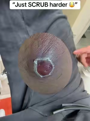 No more ingrown or bumps 🥹