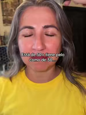 No puedo creer esto… 10/10 #hairgrowthtips 