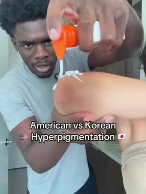 Oh my! #hyperpigmentation #discoloration #bodywash #glycolicacid 