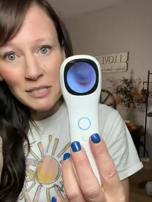 Use on pets as well as humans. Check ears, nose, throat and skin. We use ours all the time, but especially during golden blue season. Make sure you have one on hand. #Endoscope #earwaxremoval #medicalsupplies #momlife #earinfection 