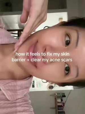 legit glass skin cream😮‍💨🫶🏻 #dralthea #dralthea345cream #clearskin #acne #koreanskincare