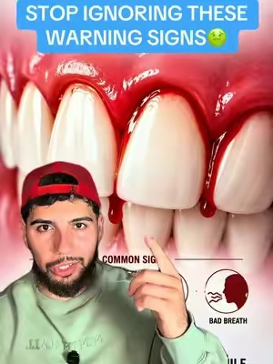 Most people neglect their gum health and pay the price later when they’re older😔🤢