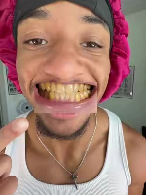 7677631212856347918