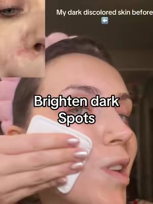 How to even put skin tone and get rid of dark spots and discoloration on your face #darkspottreatment #darkspotcorrector #brightenskin #farmacybeauty #tiktokshopcosmetics 