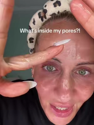 That’s insane 🫣 #DrMelaxin #CactoxPoreCleansingDuo #PoreCare #CloggedPores #KoreanSkincare 