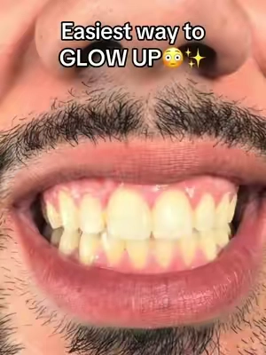 How to doordash the veneer allegations😭✨ #drdreamwhite #drdreamwhitening  #teethwhiteningstrips #purpleteethwhitening #TikTokShopDealsforYouDays