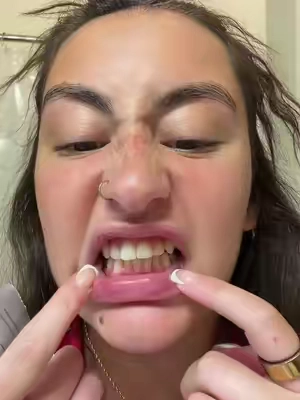 the best whitening strips!!!  #drdreamwhite #drdreamwhitening #whiteningstrips #teethwhiteningstrips #purpleteethwhiteningdays 