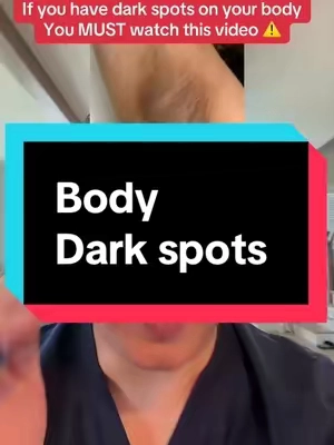 Dark sport on your body are created because of melanin. And one of the best way to help is to use tranexamic acid with a exfoliant to help stop melanin production and get rid of dead dark skin. @celimax US Store has both in a exfoliating pad that can help with the dark spots on your body. Just a quick disclaimer: While I’m a licensed pharmacist, the advice I share here is for general educational purposes only. Always check in with your own doctor or healthcare provider for personal medical advice.  #darkspots #exfoliating #tranexamicacid #celimax #TikTokshopbacktoschool 