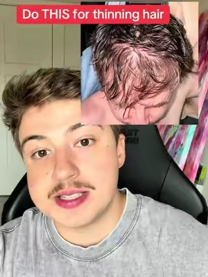 If your hair is thinning you should watch this 