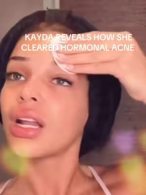 The best skincare product money can buy😫 #medicube #skincare #LoveIsland 