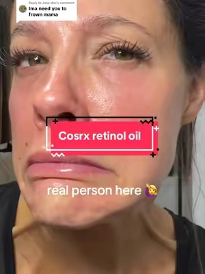 Replying to @Jane doe I know it’s easy to look at skincare videos and wonder how much of what you’re seeing is actually real. So here I am, in real lighting, showing you what my skin looks like as a 40-year-old. No hiding the texture, lines, or everything that comes with having an actual face. 😂 I’m just documenting what happens when I stick with a product and let you decide what you see. #COSRX #SkincareTok #MatureSkin #SkincareRoutine #TikTokShop @COSRX US 