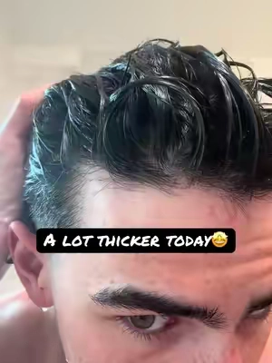 #thinninghair #thickerhair #haircareroutine #hims 